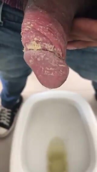 unwashed smegma cock bbc pissing