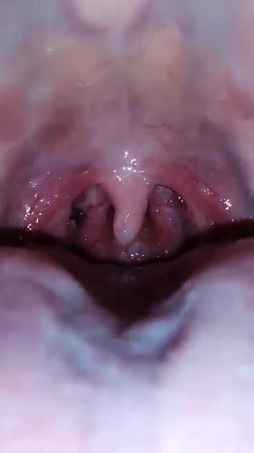 Famale shows her uvula and and tonsils