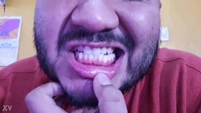 Look inside this man's mouth