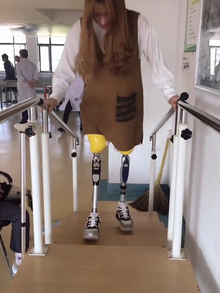 Dak woman practice on stairs with prosthetics 2