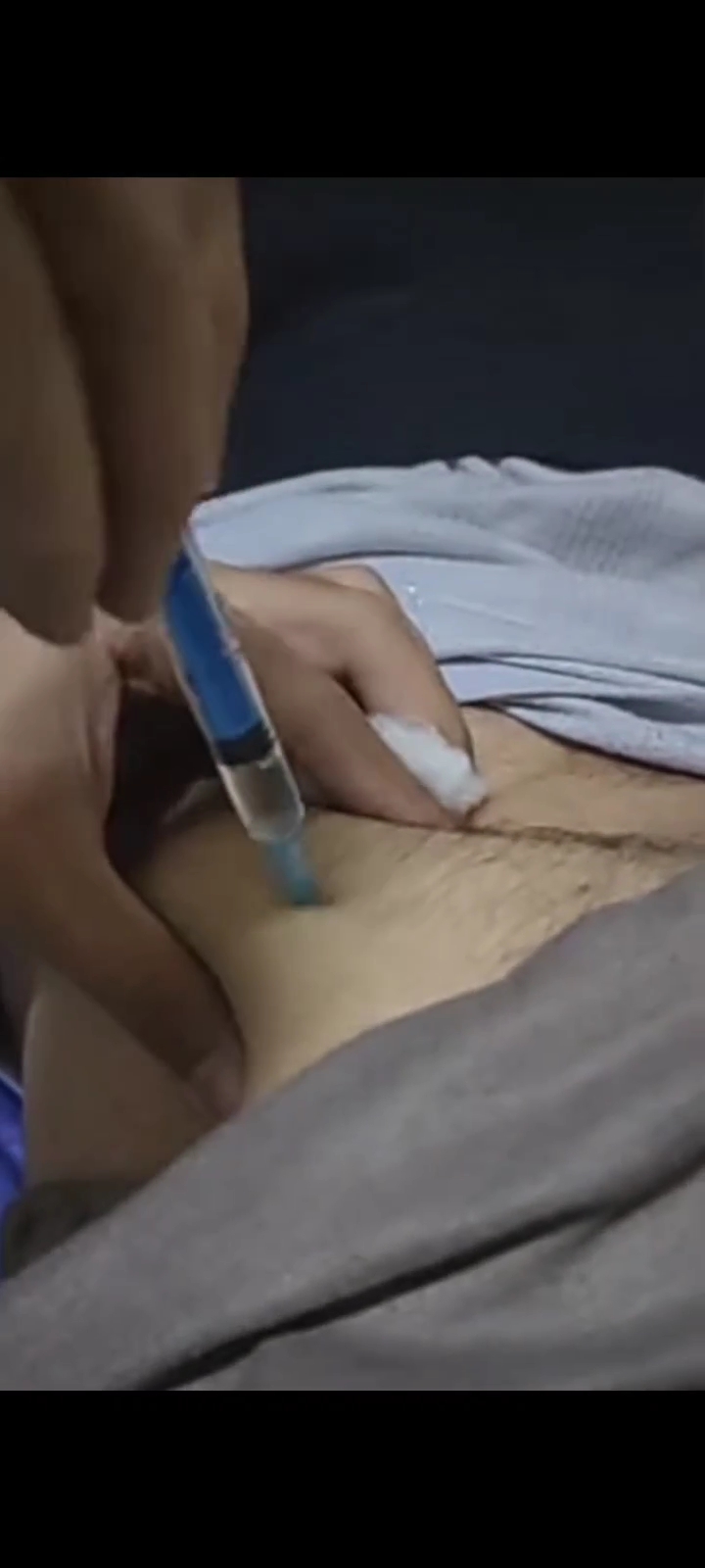 Buttocks injection - video 3
