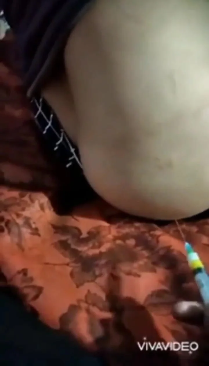 Buttocks injection - video 4