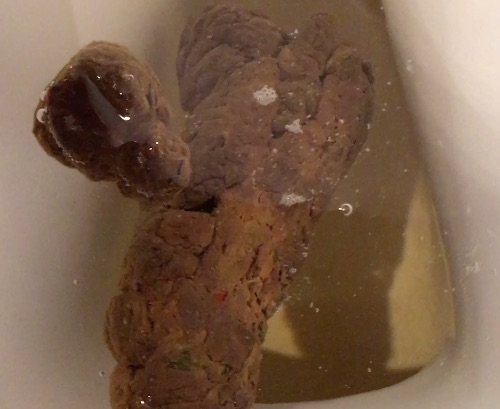Struggling To Shit plus Piss