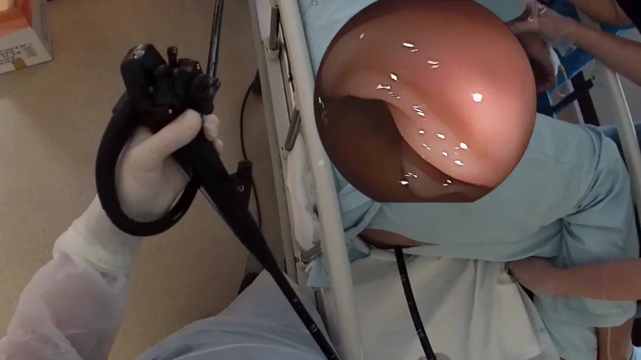 Colonoscopy Porn - Korea colonoscopy videos - ThisVid.com