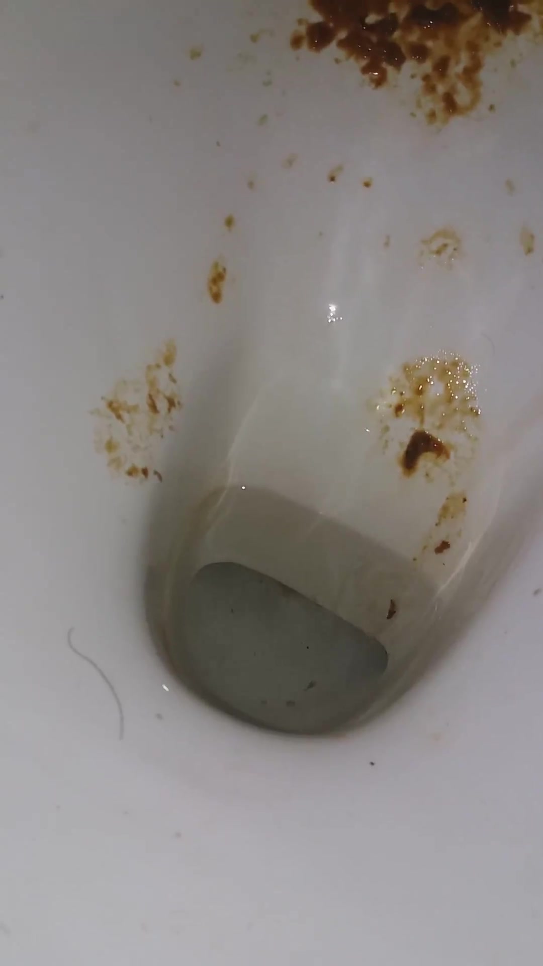 diarrhea - video 52