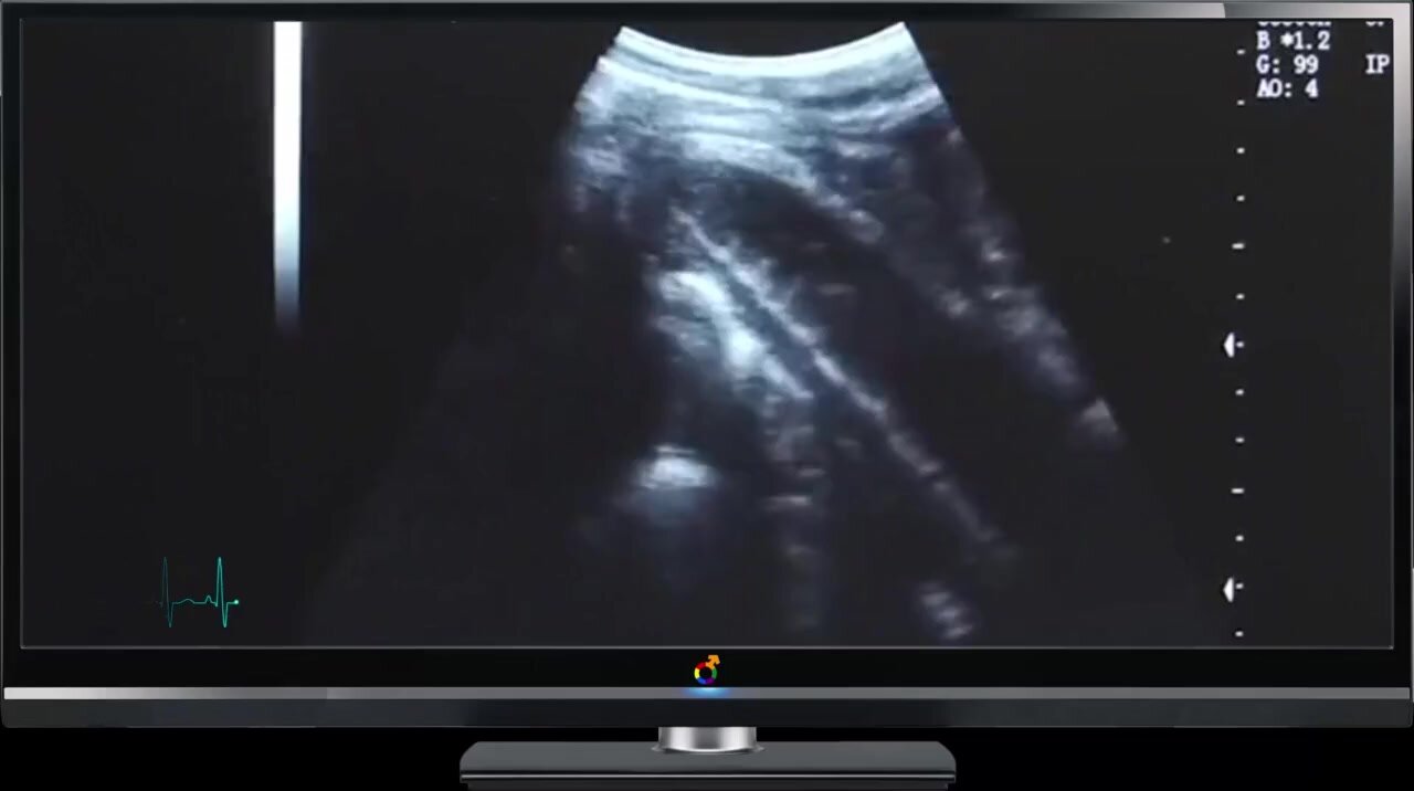 Sex with ultrasound