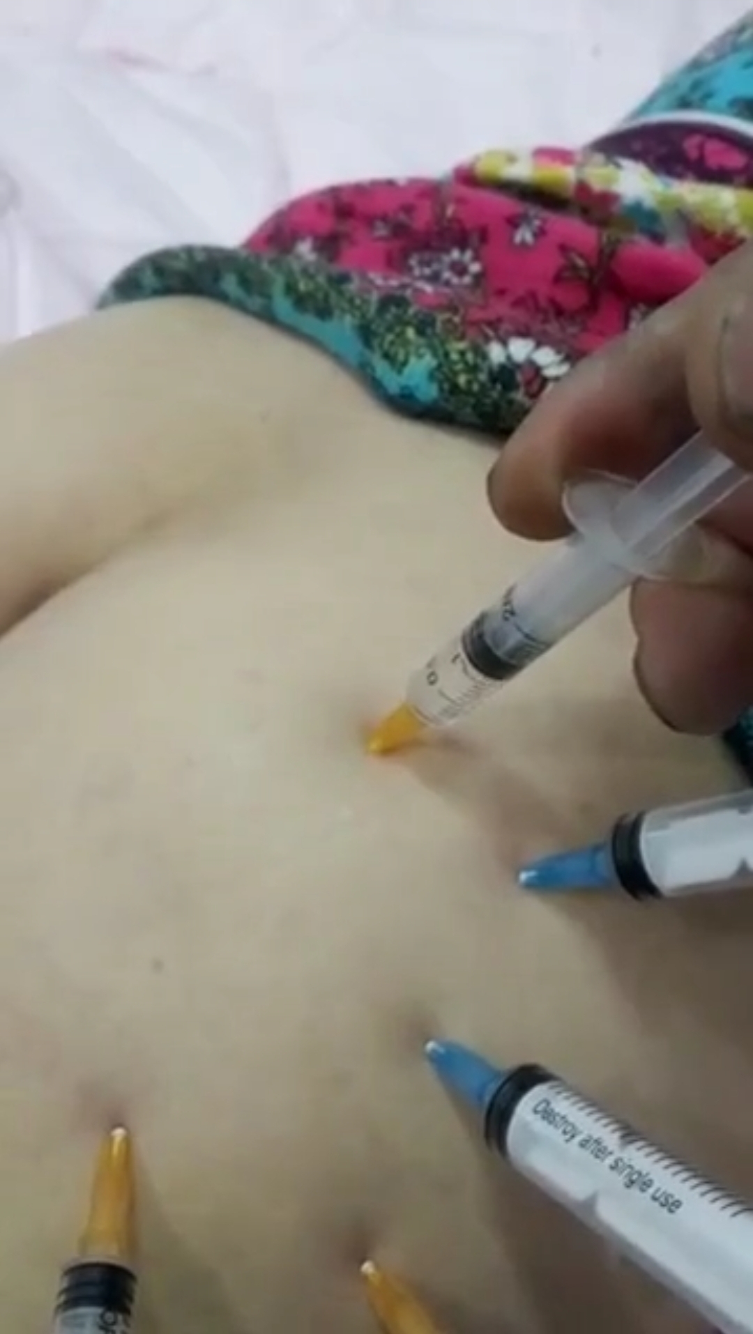 Injection in girls ass