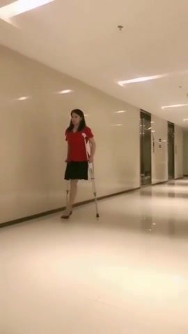 Chinese amputee woman