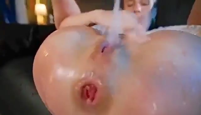 massive squirt with prolapse