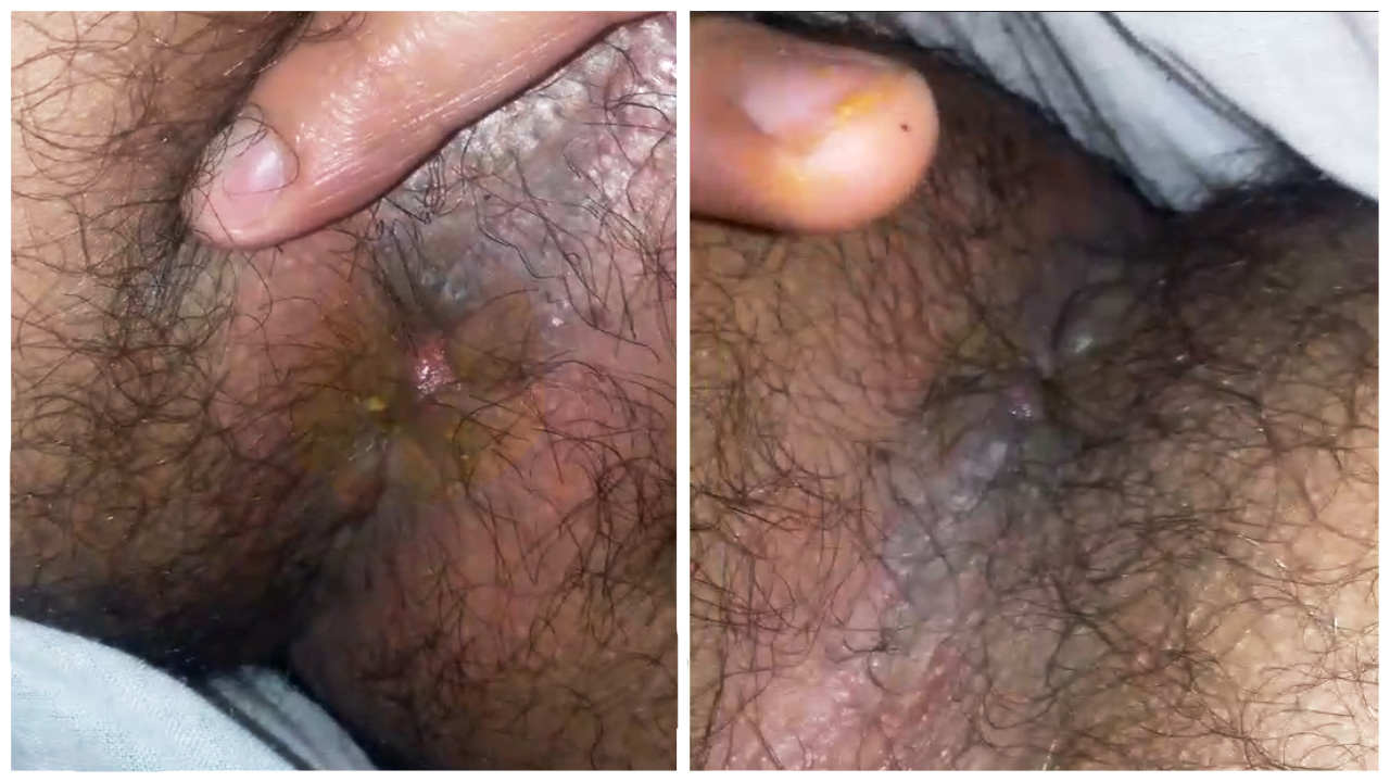 HAIRY ass guy FINGERS his DITY HOLE after cum (part 2)