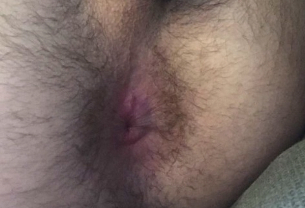 Hairy hole - video 5