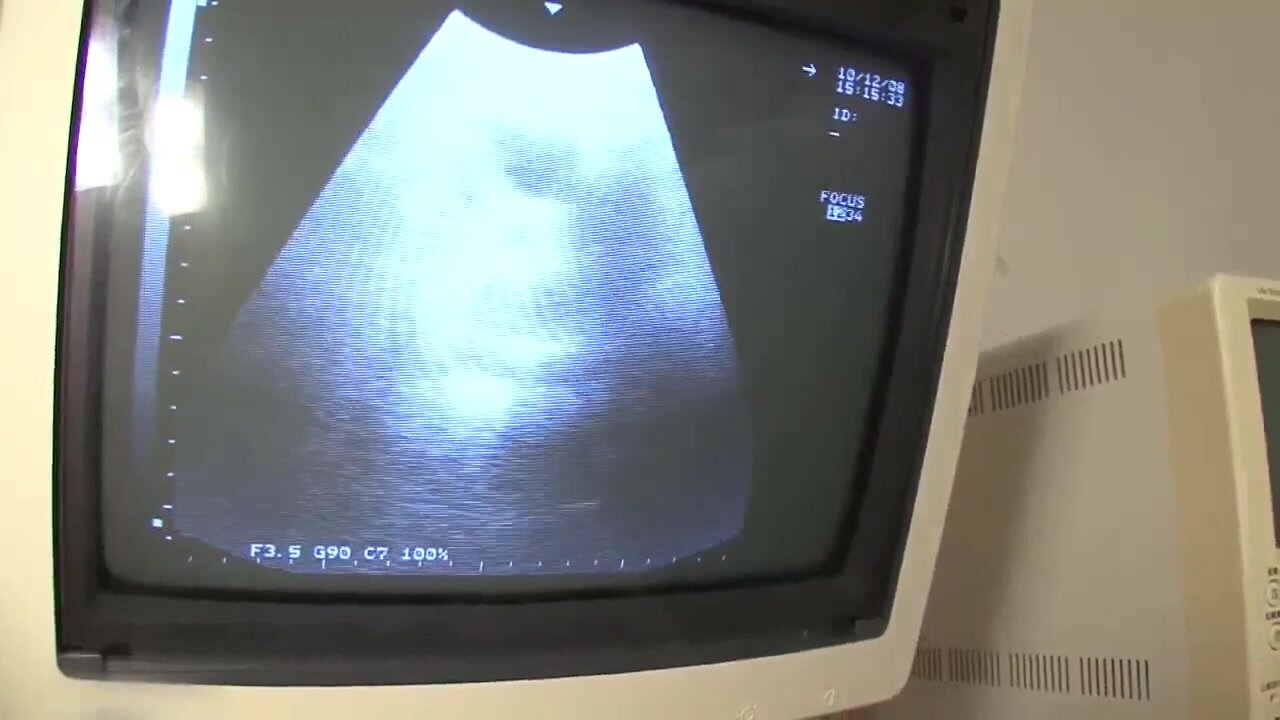 Ultrasound while having sex scene from JAV - ThisVid.com