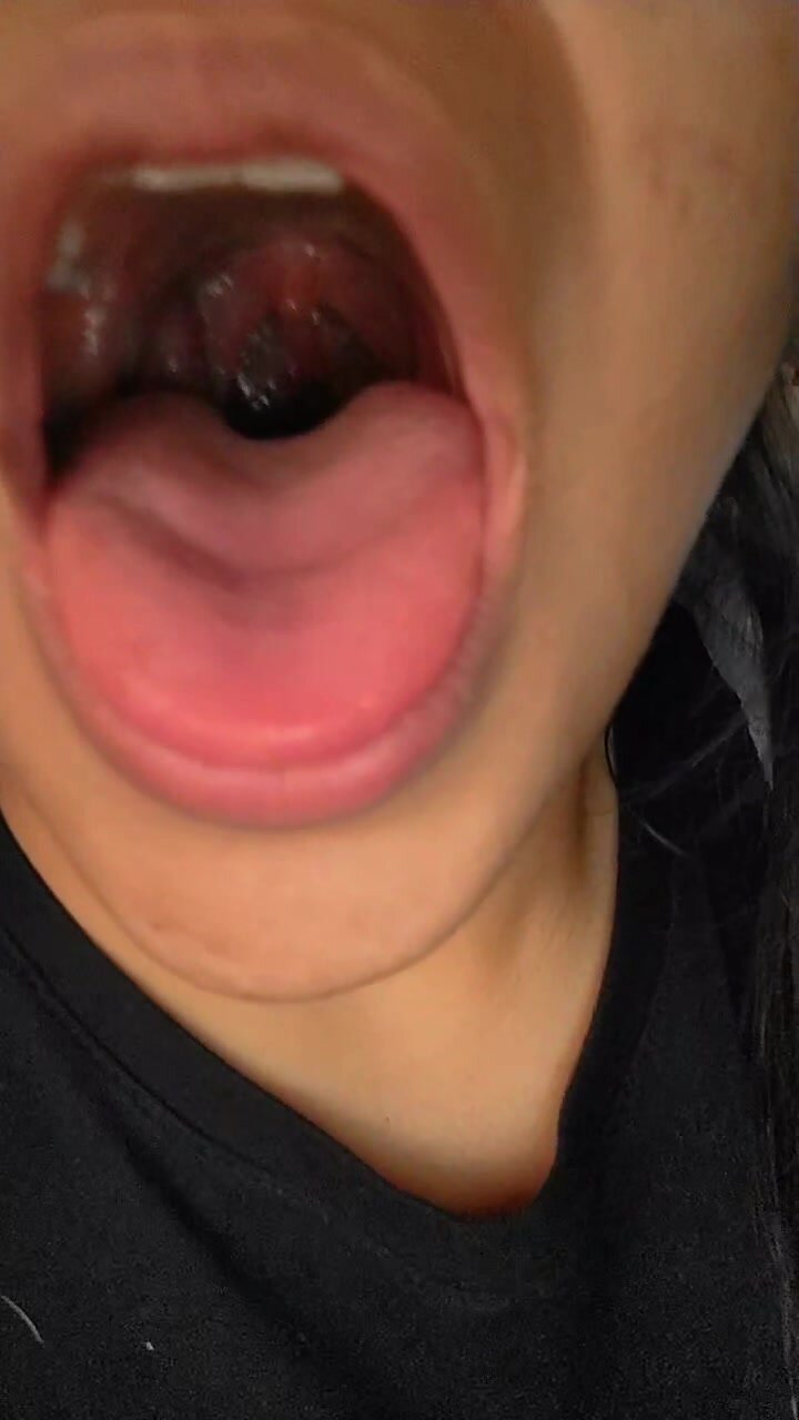 Woman little uvula view