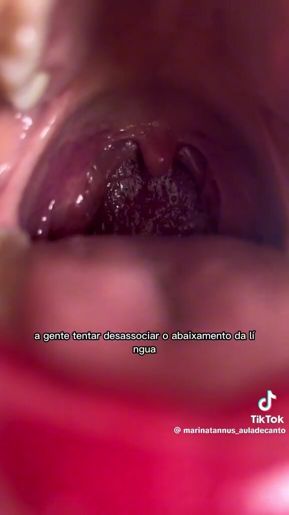 Singer shows her full mouth and uvula