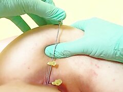 Anal needle fucking part 2