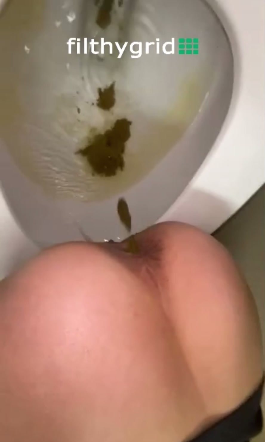 Pooping in Dental Office