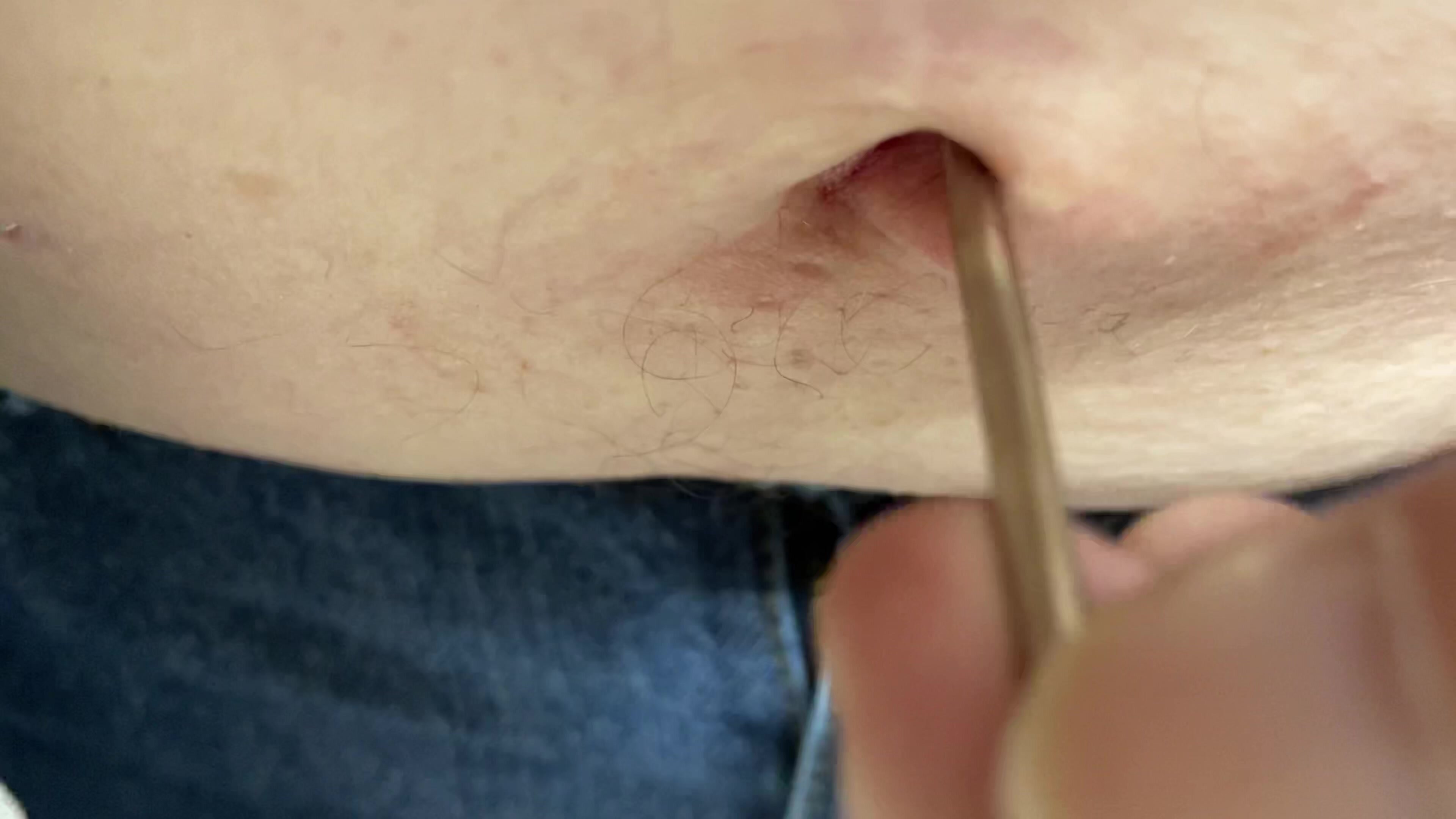 First penetration