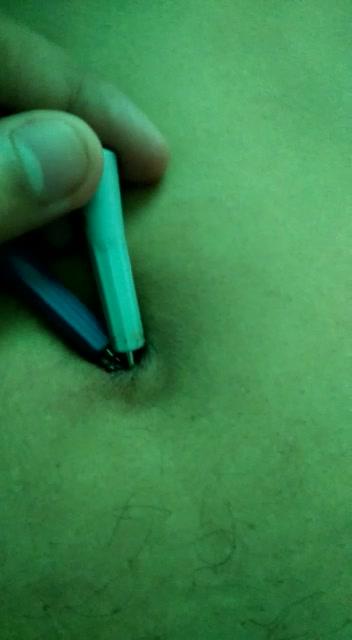 Recent my navel stabbed 7