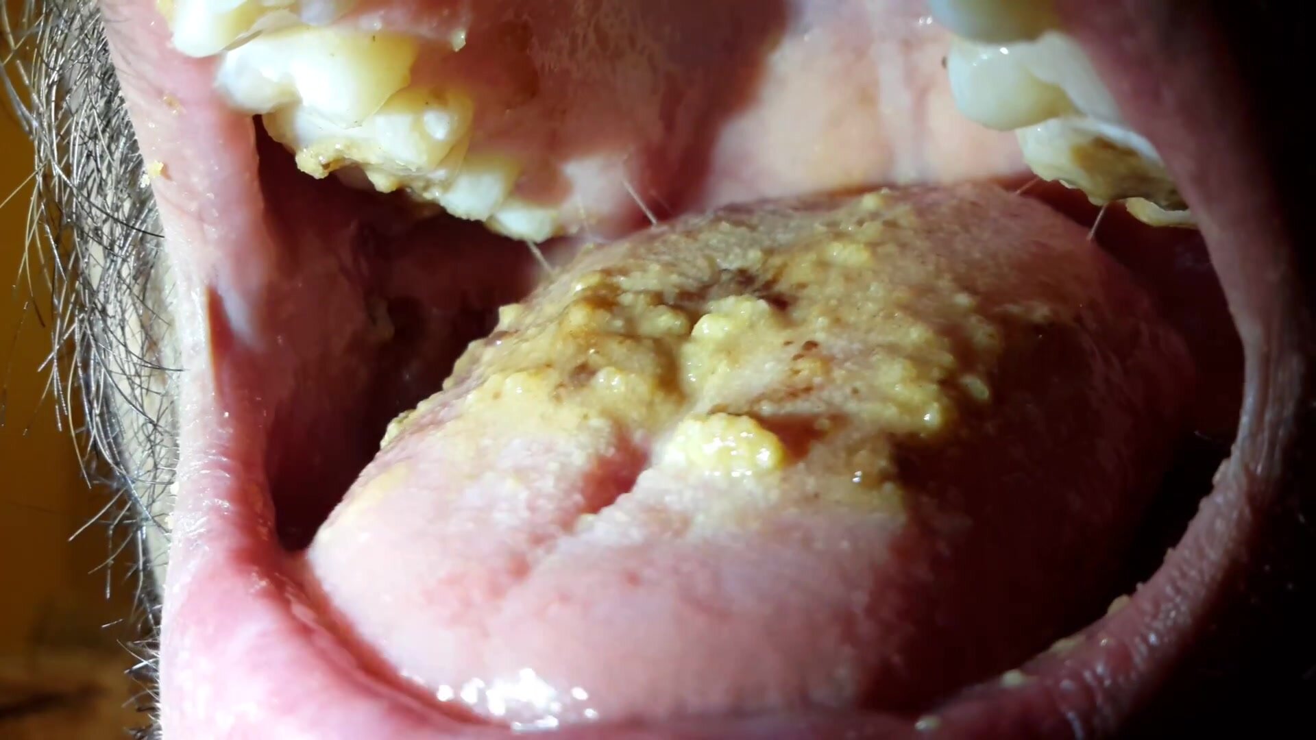 Mouthcam human tongue with food