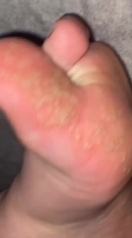 Chubby girl shows her awful feet