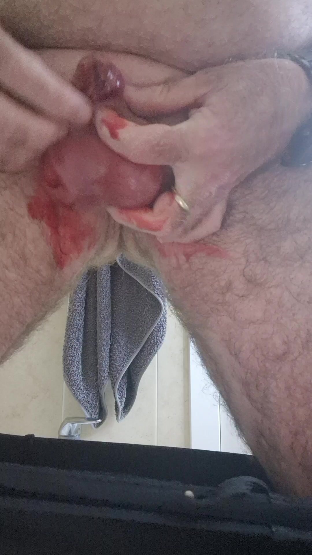 my little dick after needless and cut