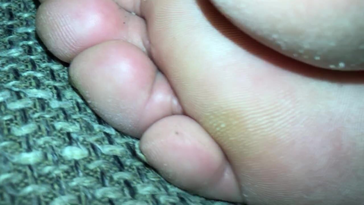 I love my Amateur Milf slepping dry soles black toenail