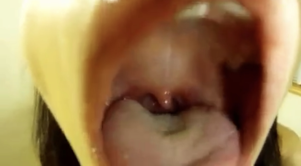 mouth video 1