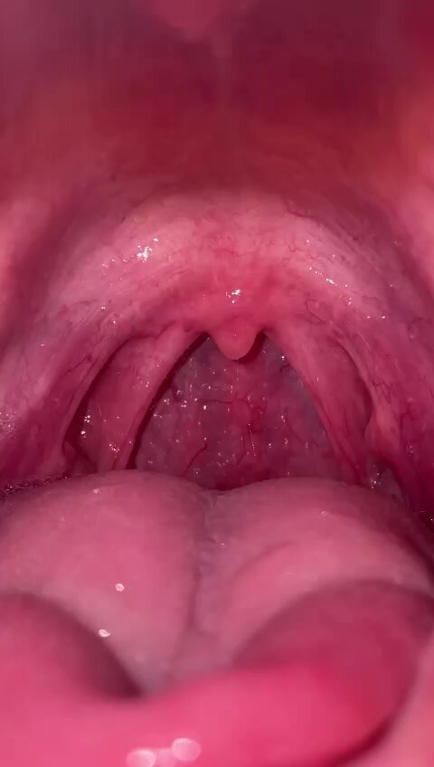 My mouth wide open in a little close up