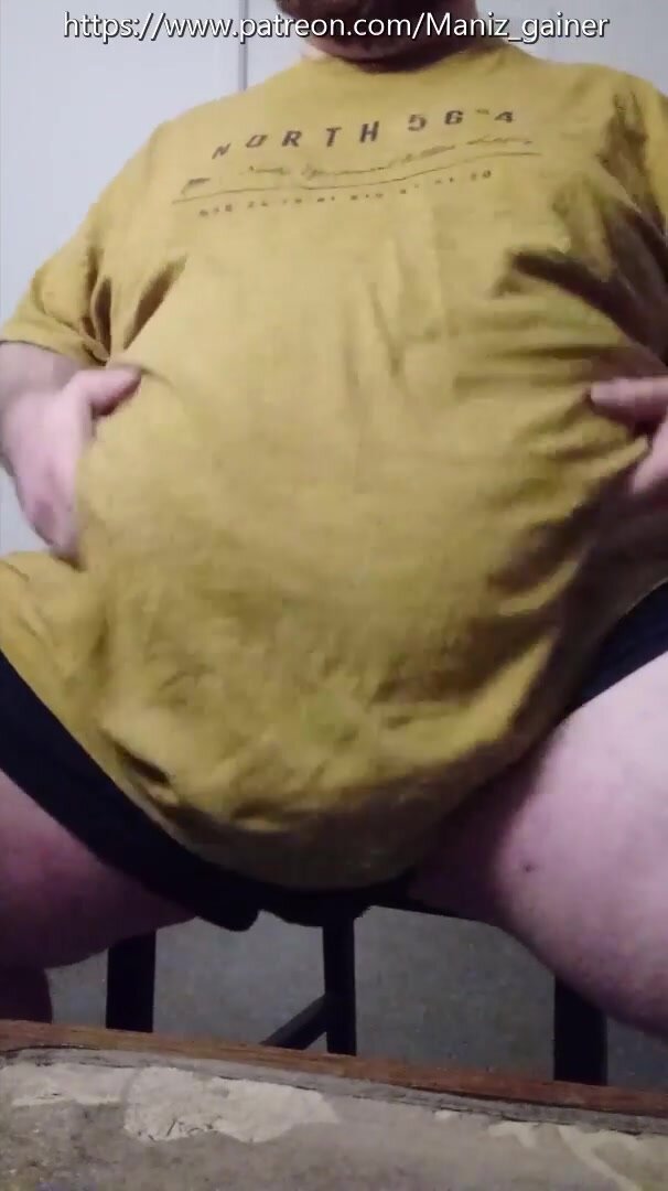 Obese massive belly