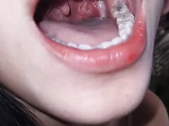 Asian girl uvula 10