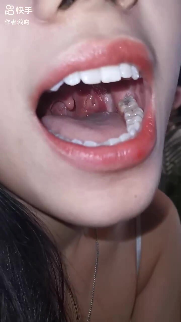 Asian girl uvula 10