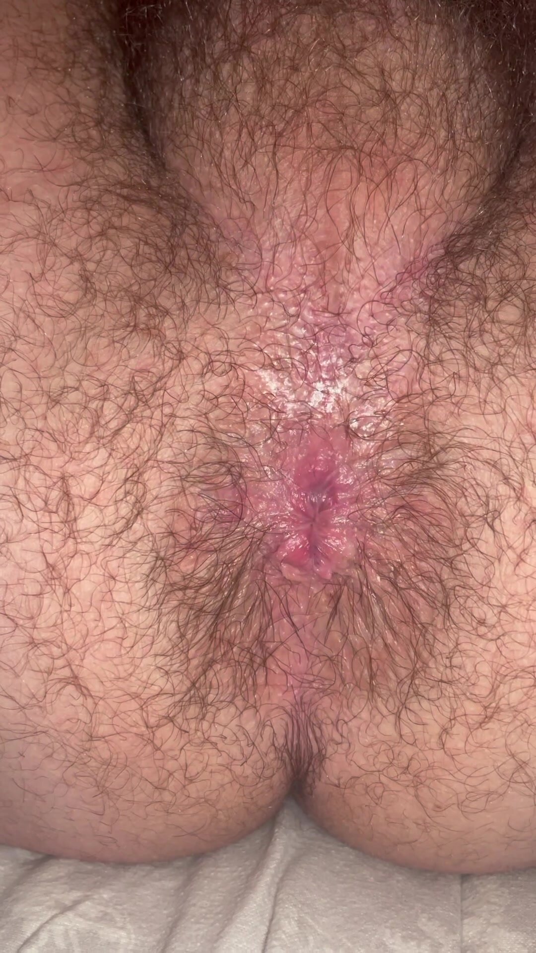 Hairy hole rips one