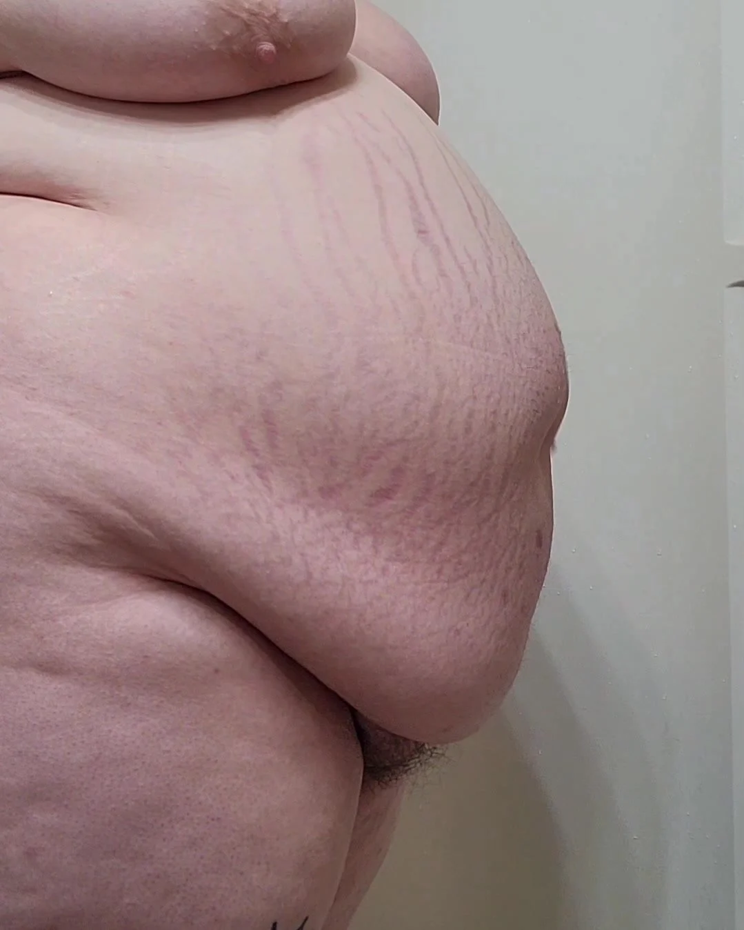 Belly inflation: BBW Enema Inflation - 3L - ThisVid.com