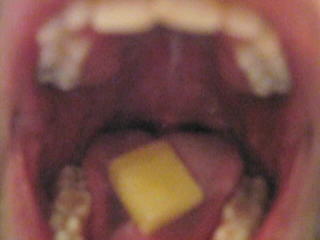Swallowing Pineapple Chunks
