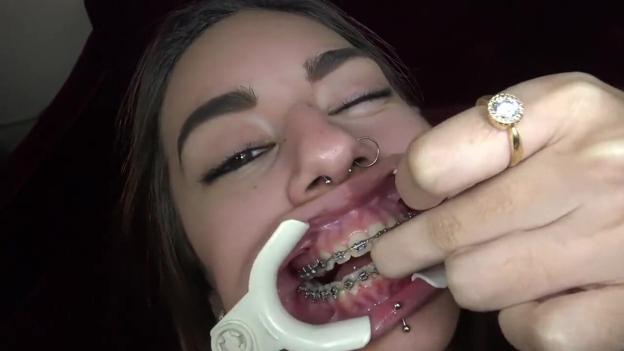 Mexican Spicy Dentist Inspection.