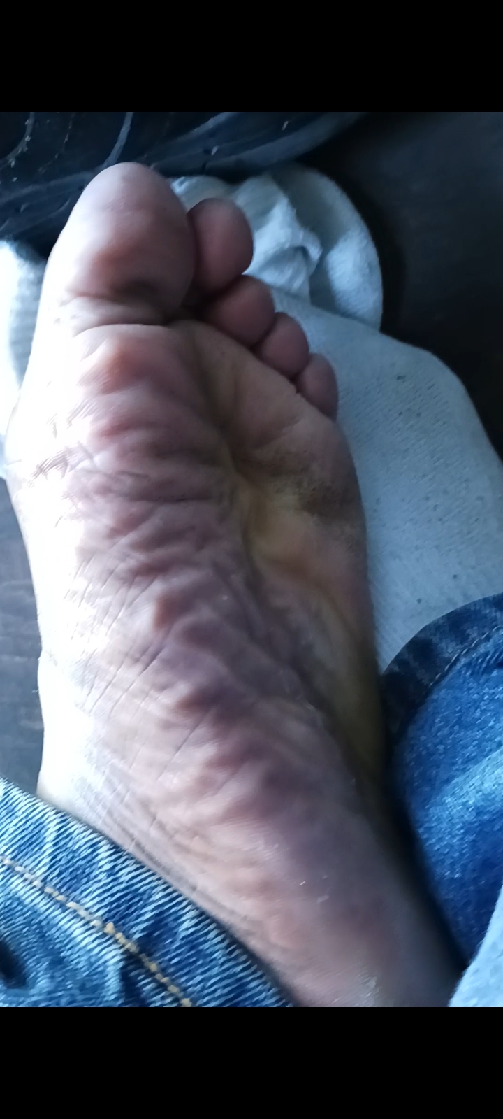 Sweaty after-work feet