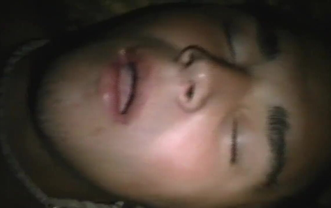 Snoring guy eye chek