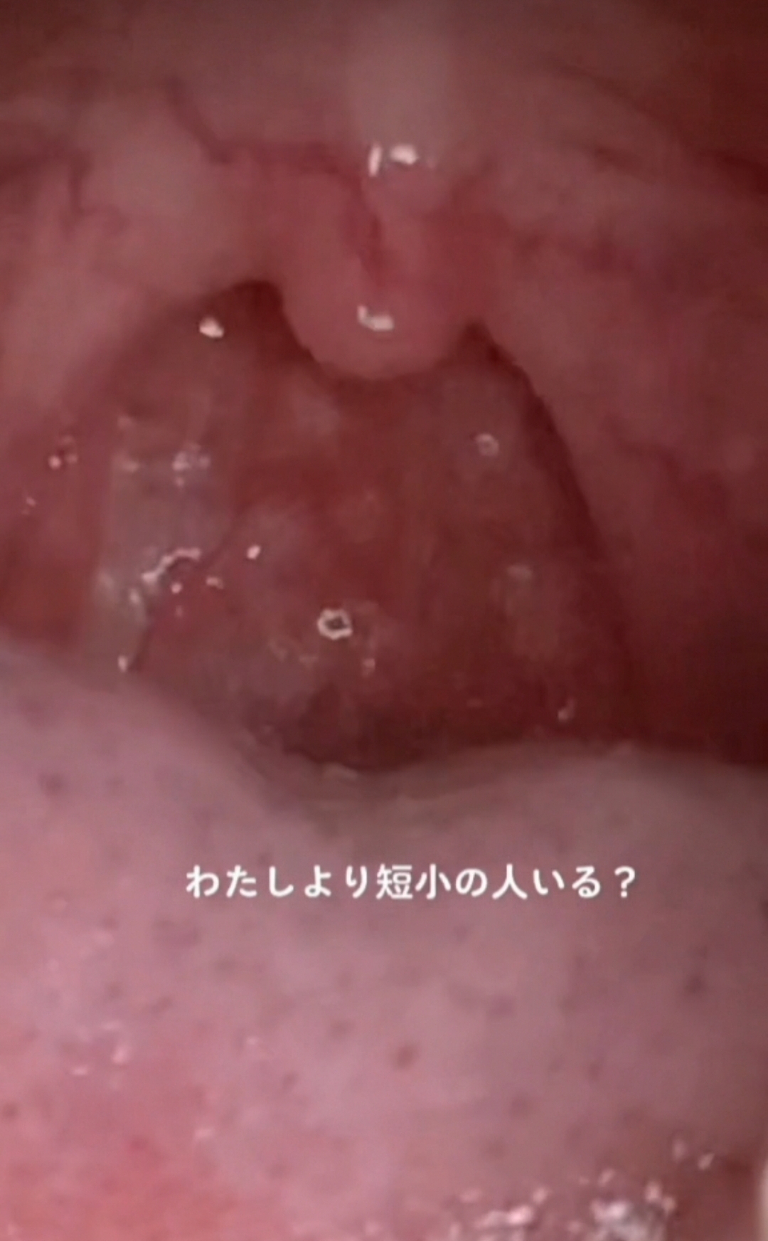japanese girl uvula 2