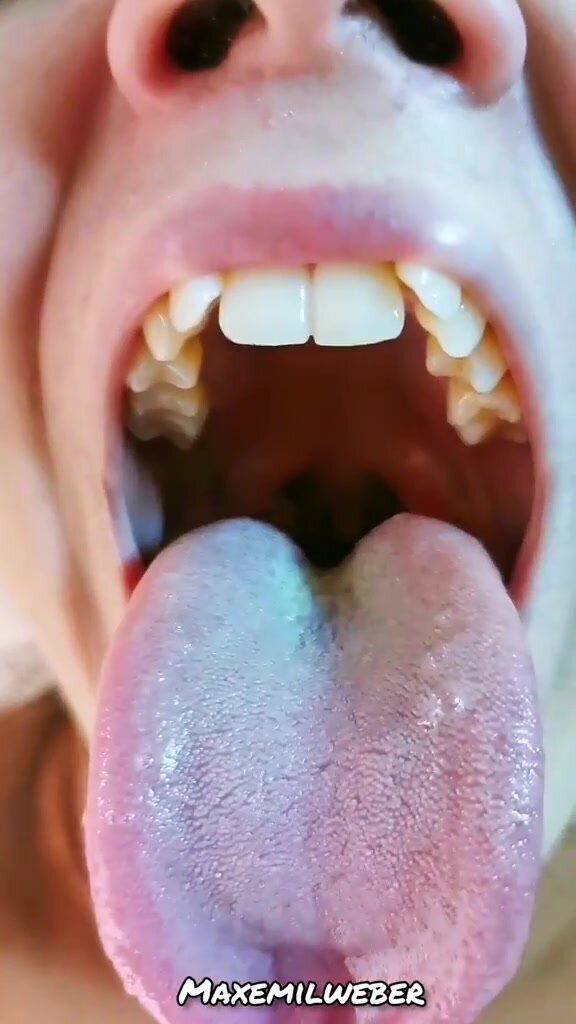 Smelly breath up close