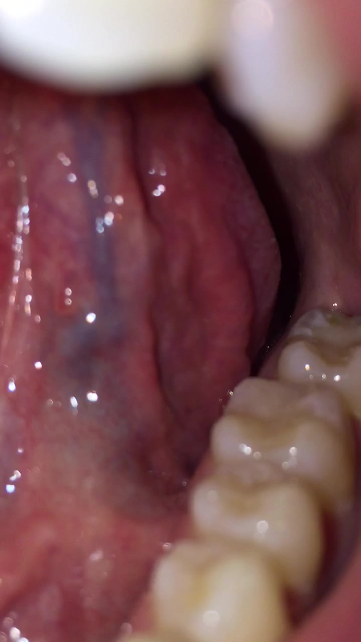 Smell my breath, see my uvula, teeth, and tongue