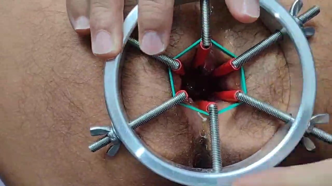 Anal expander-first steps
