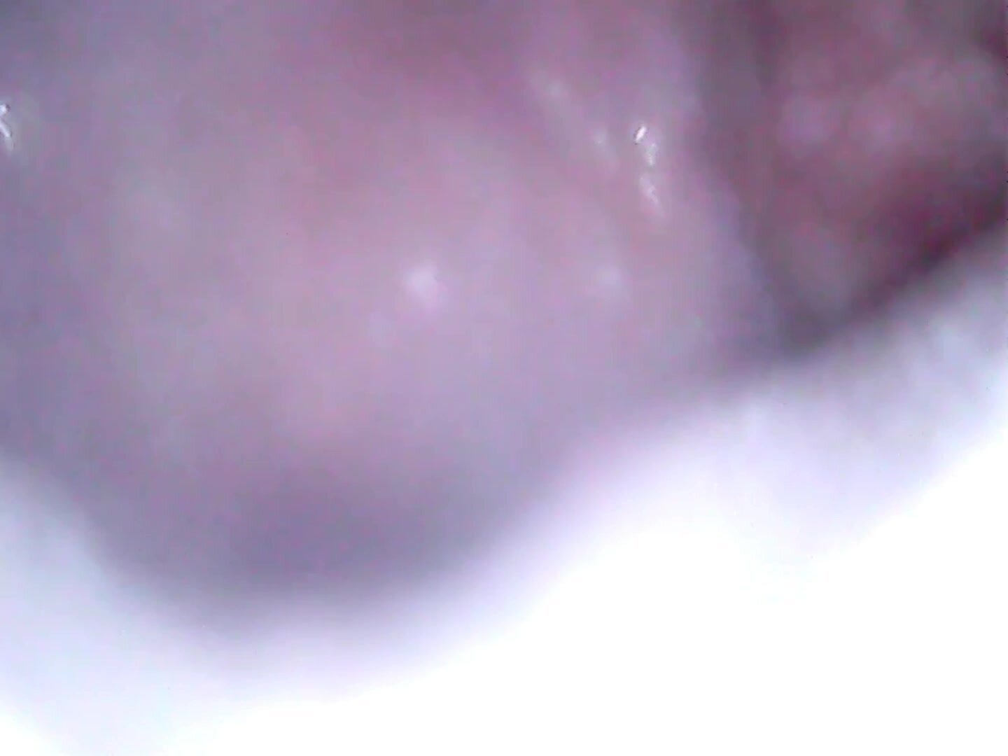 Mouth Cam - video 2