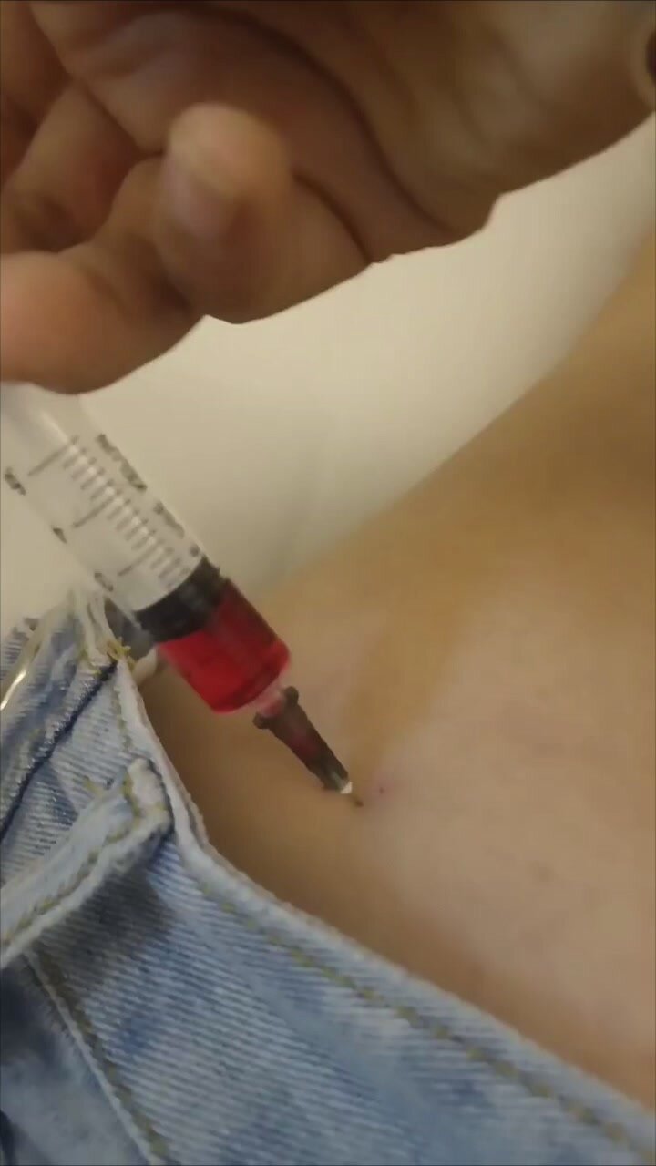 nurse injection - video 3